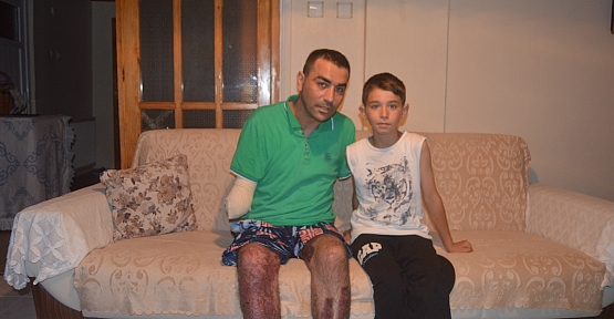 KOLLARI KESİLEN GENÇTEN, TEŞEKKÜR