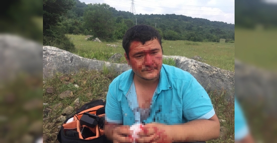 Gazeteciyi Öldüresiye Dövmüşlerdi, Tanık "Yere Düştüler" Dedi