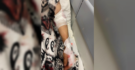 ABDEST ALMAK İÇİN BAHÇEYE ÇIKAN KADINA KÖPEKLER SALDIRDI