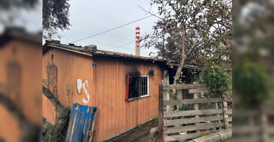 Yangında Mahsur Kalan Yaşlı Adam Hayatını Kaybetti: 2 Ay Önce Bacakları Ampute Edilmiş