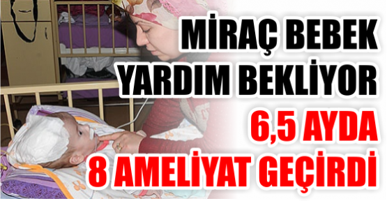 “Miraç bebek“ yardım bekliyor! 6,5 ayda 8 ameliyat geçirdi